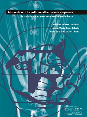 cover image of Manual de ortopedia maxilar